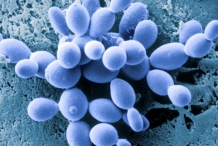 Brewer's-yeast-fungus-2
