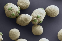 Brewer's-yeast-fungus