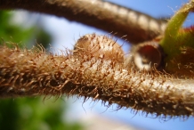 Close-view-of-Kiwifruit-skin