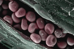 Fungal-spores-in-lemon-grass-leaf-no-scale-bar