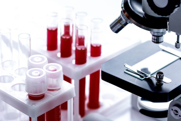 Why Blood Tests Are Important For Diagnosis