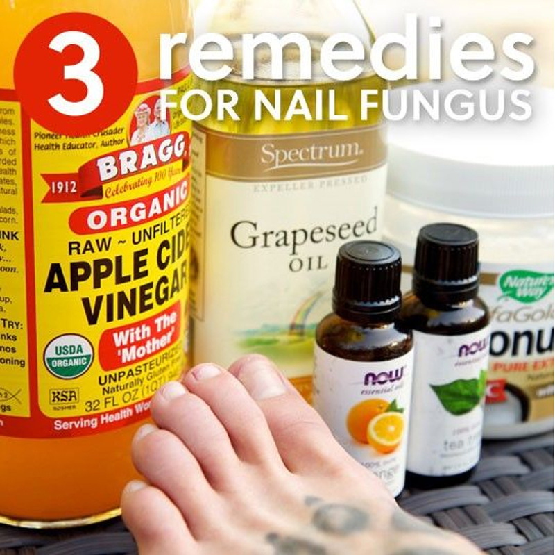 What Kills Nail Fungus Fast? Everything You Need To Know About Nail Fungus