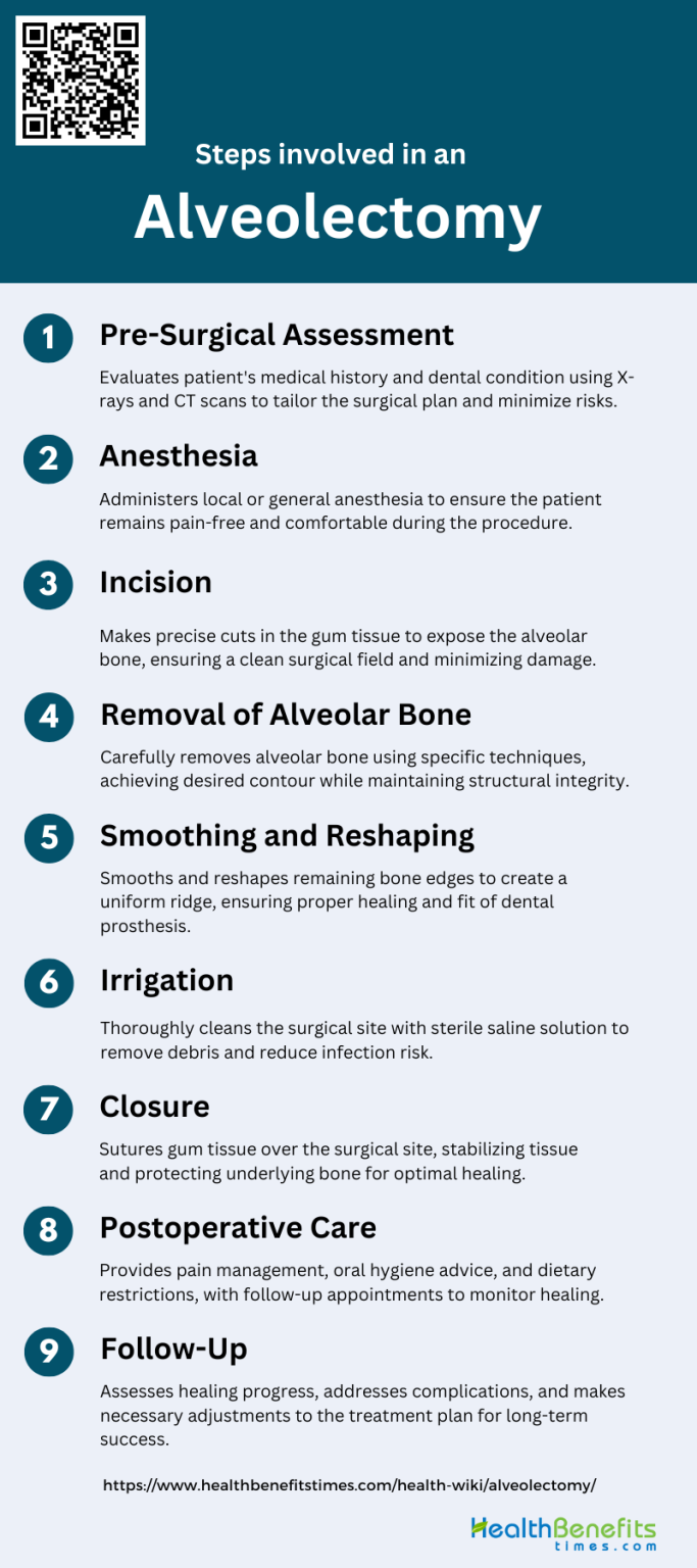 Steps involved in an Alveolectomy Health Benefits