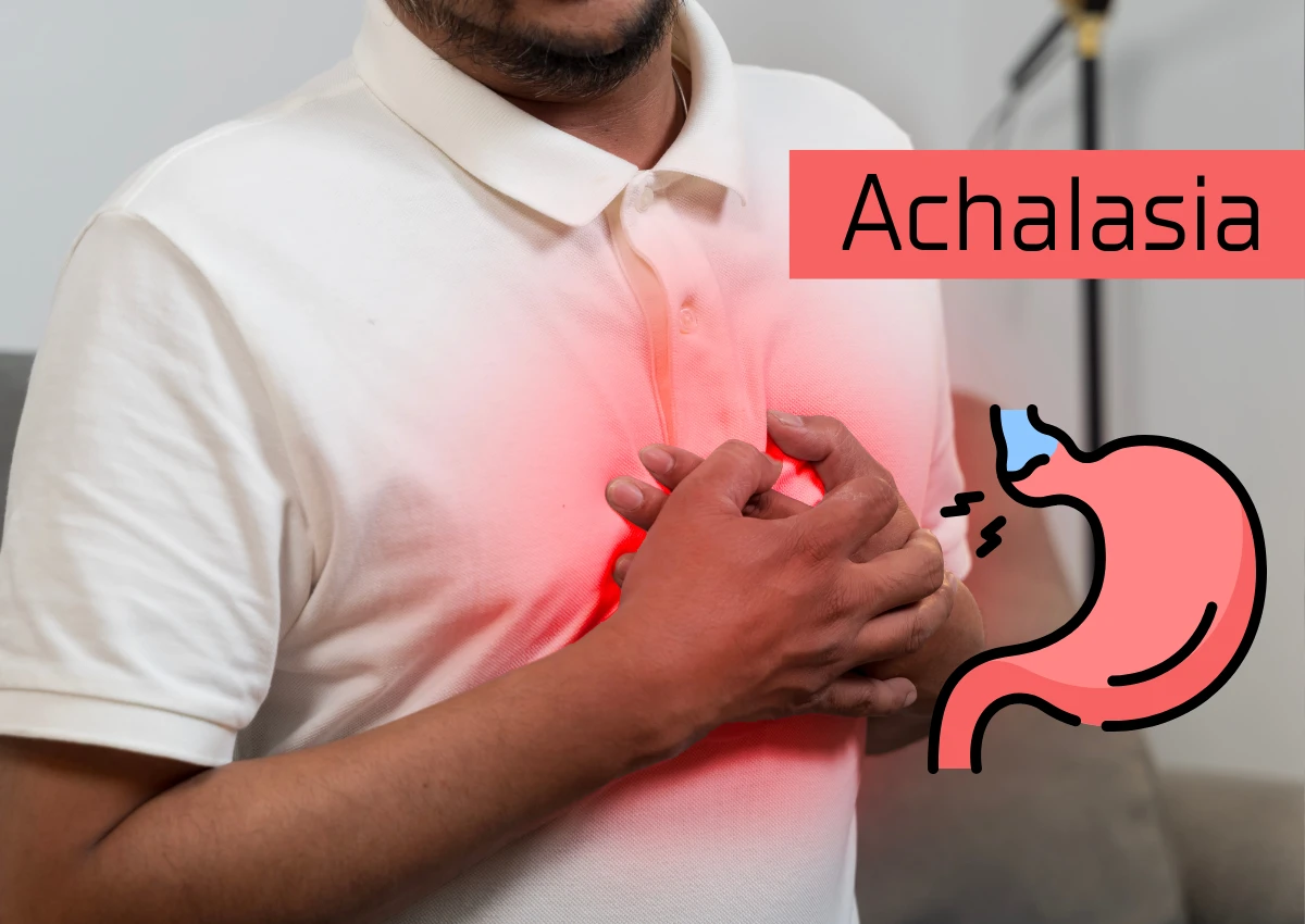 Achalasia