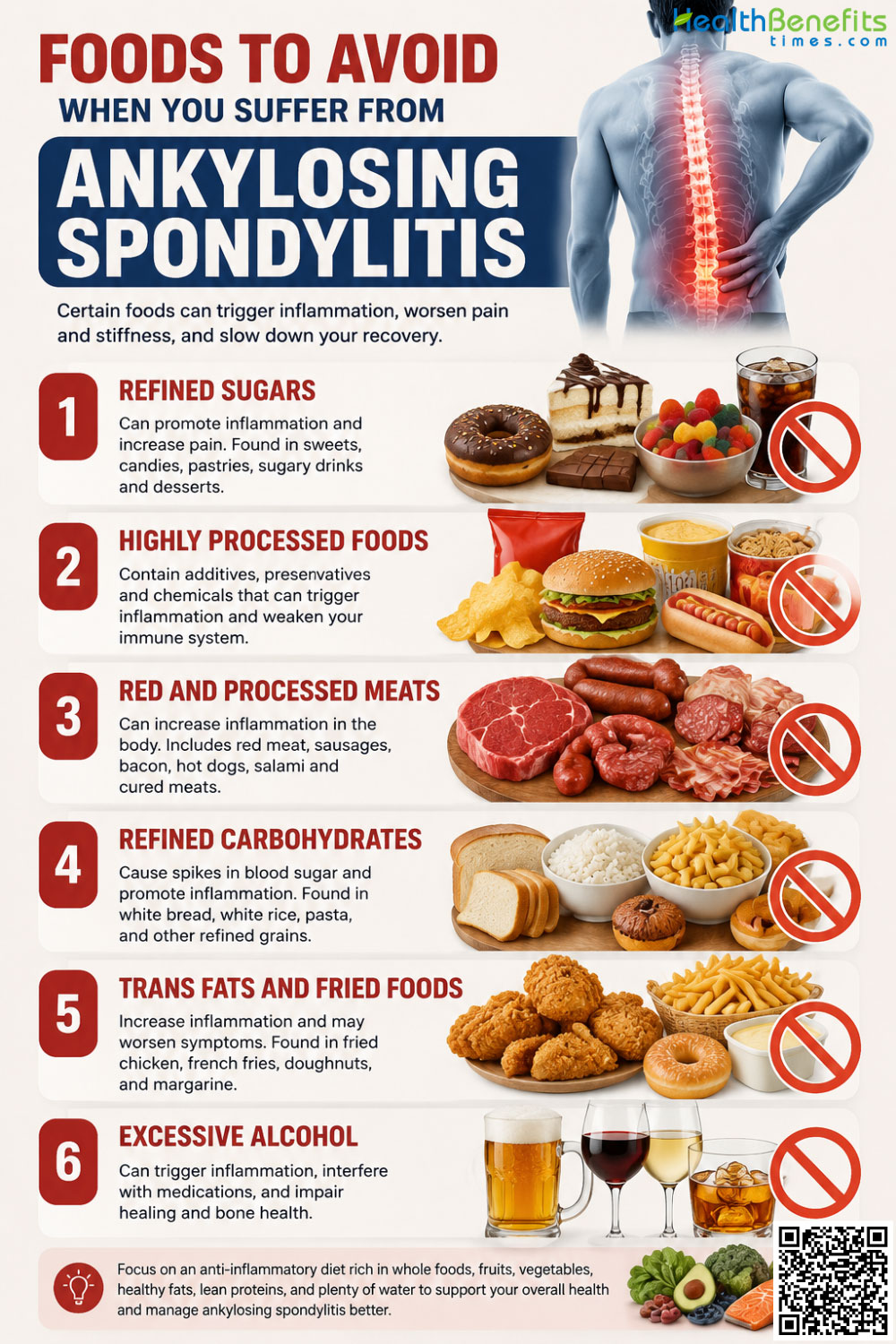 Foods to Avoid When You Suffer from Ankylosing Spondylitis