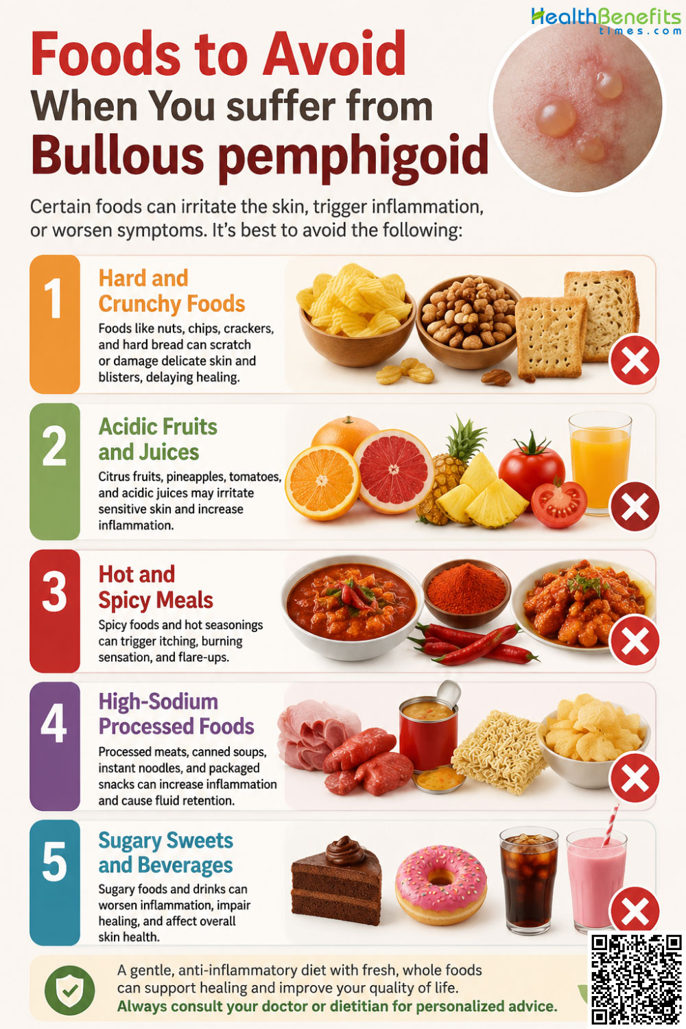 Foods to Avoid When You suffer from Bullous pemphigoid