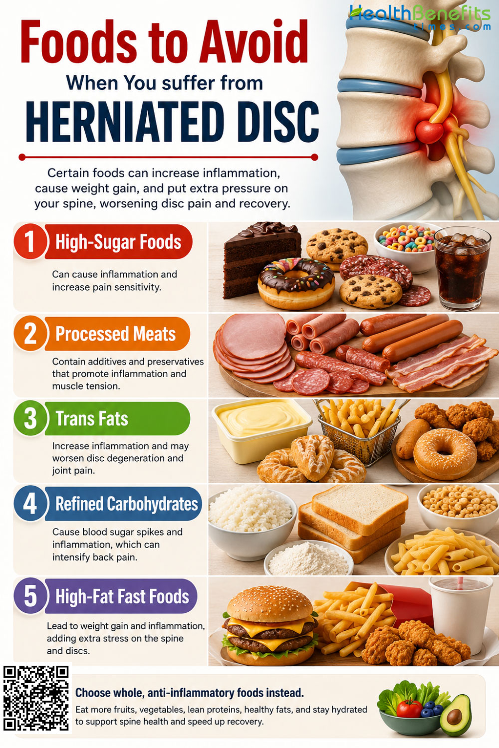 Foods to Avoid When You suffer from Herniated Disc