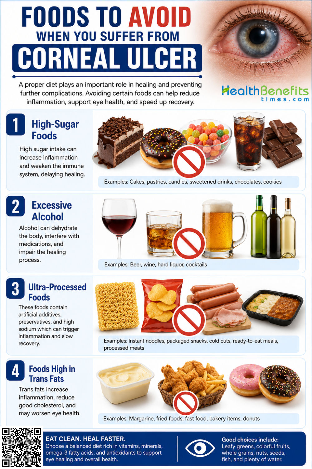 Foods to Avoid When You suffer from Corneal Ulcer