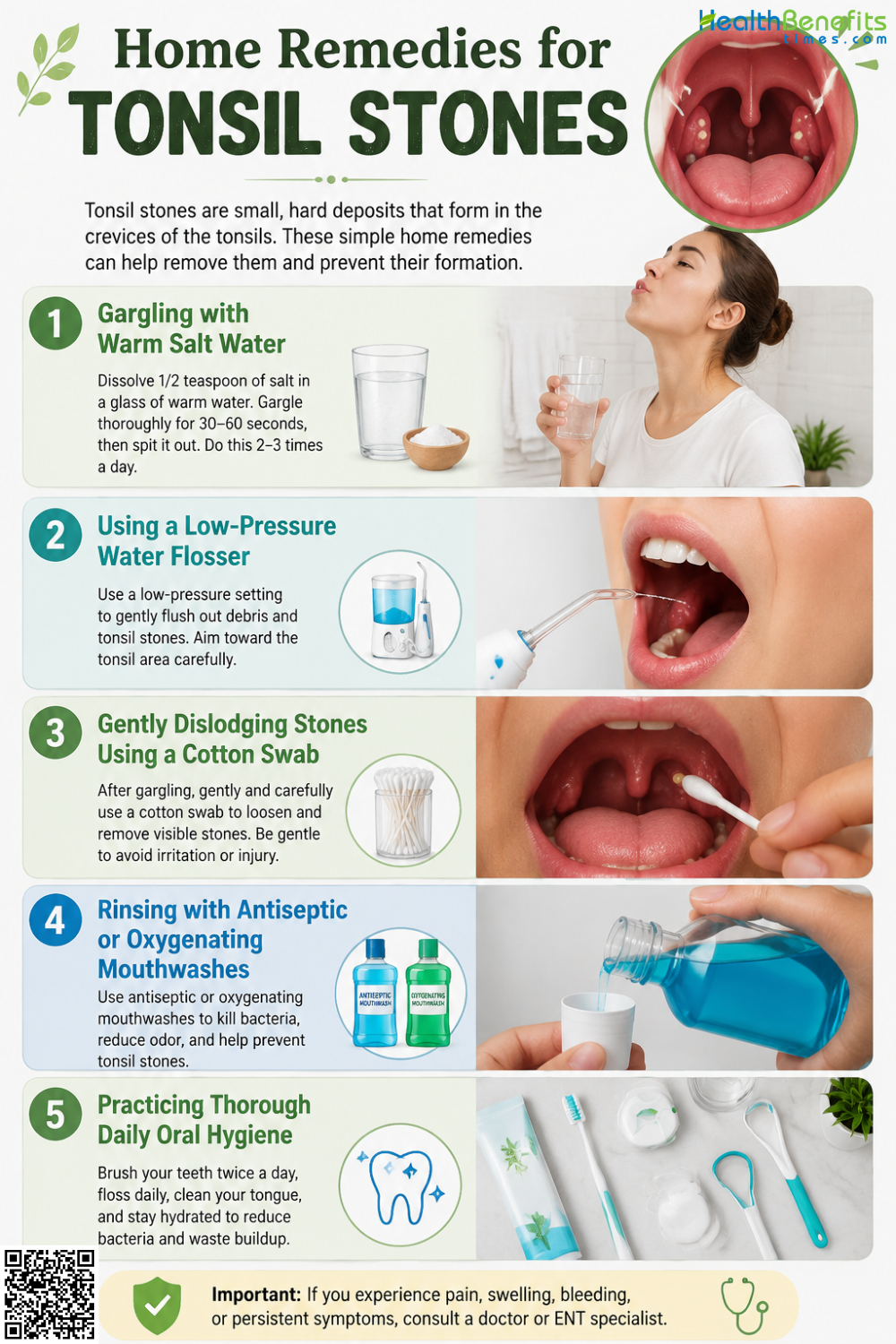 Home Remedies for Tonsil stones