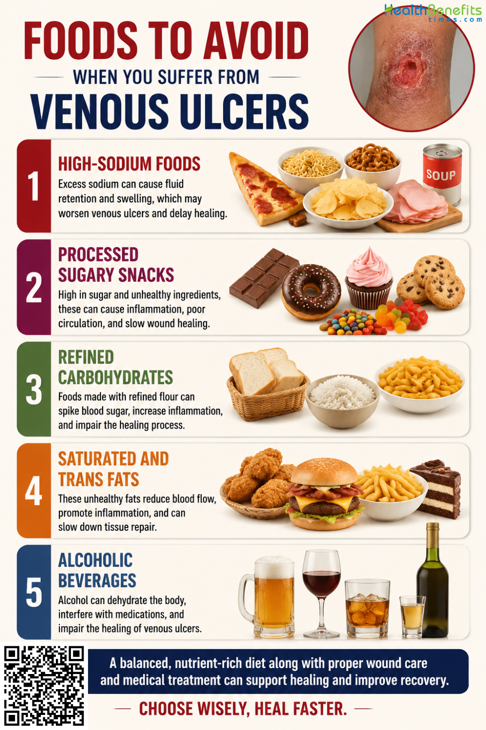 Foods to Avoid When You Suffer from Venous Ulcers