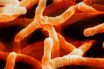 Actinomyces israelii