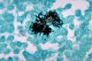 Actinomyces naeslundii