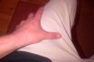 Allodynia