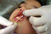 Anesthetic