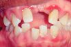 Periodontal a (Parietal a)