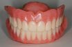 Complete denture prosthetics