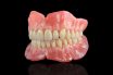 Complete denture prosthodontics