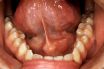 Salivary glands