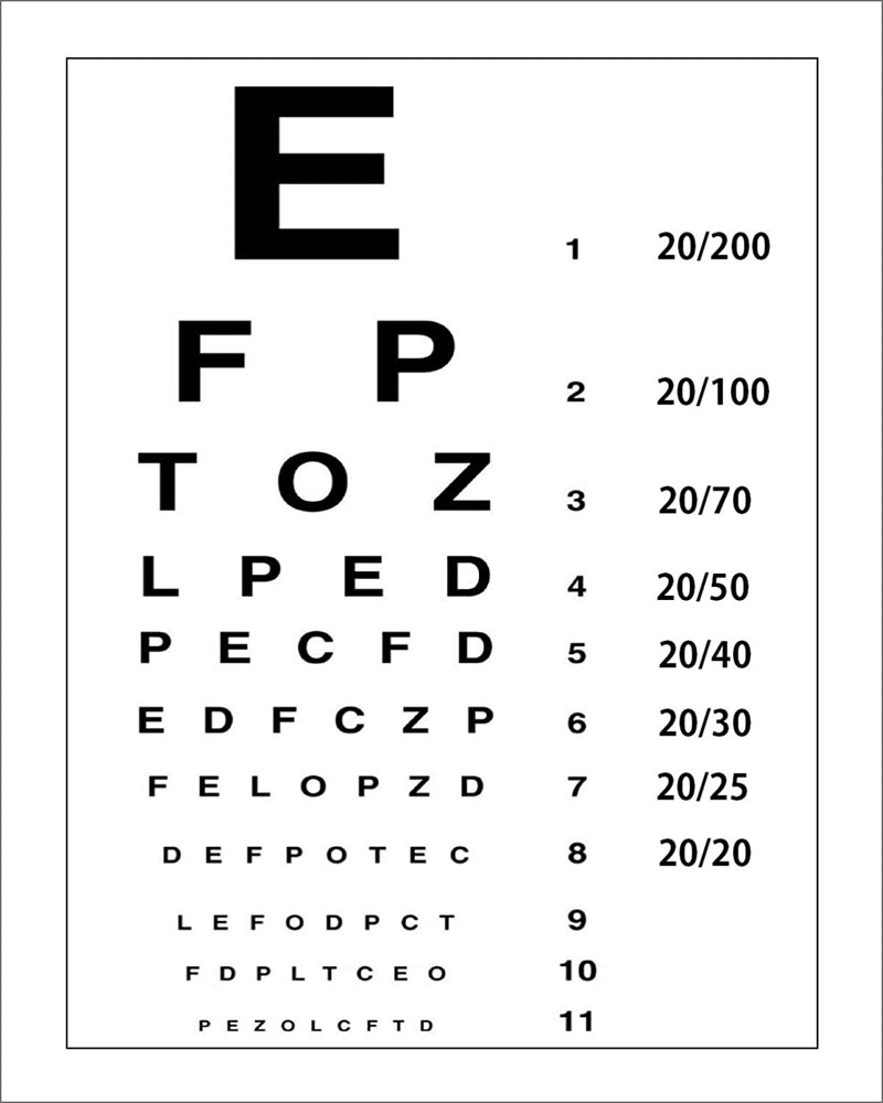 Eye test - Definition of Eye test