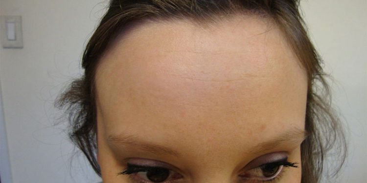 Forehead - Definition of Forehead